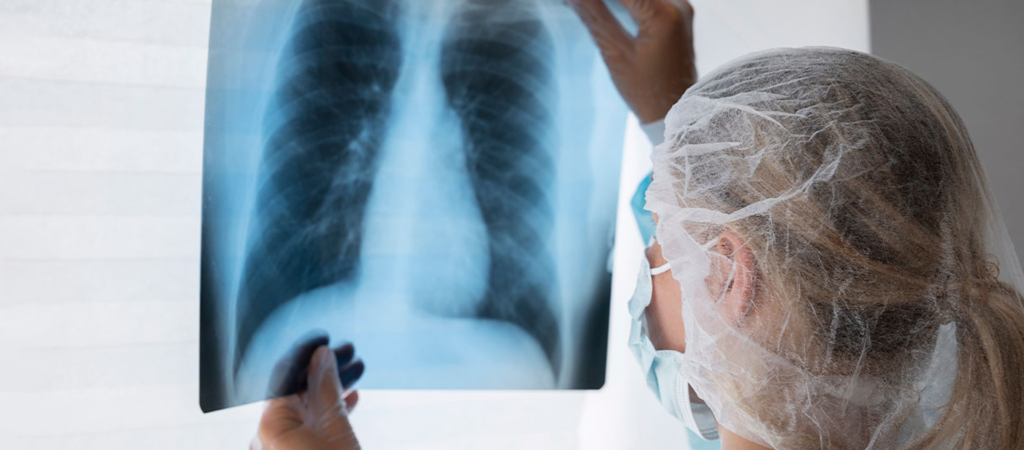 Quando devo procurar um cirugião torácico